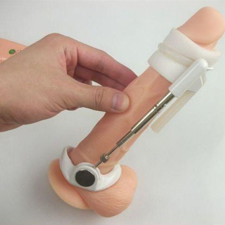 An extender will help increase the size of the penis without creams